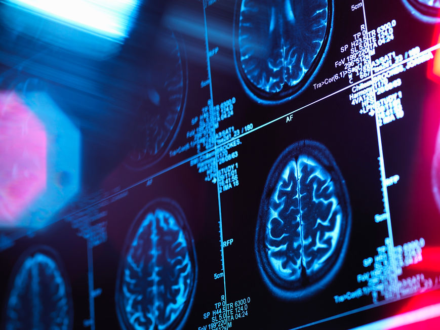 Human brain scan