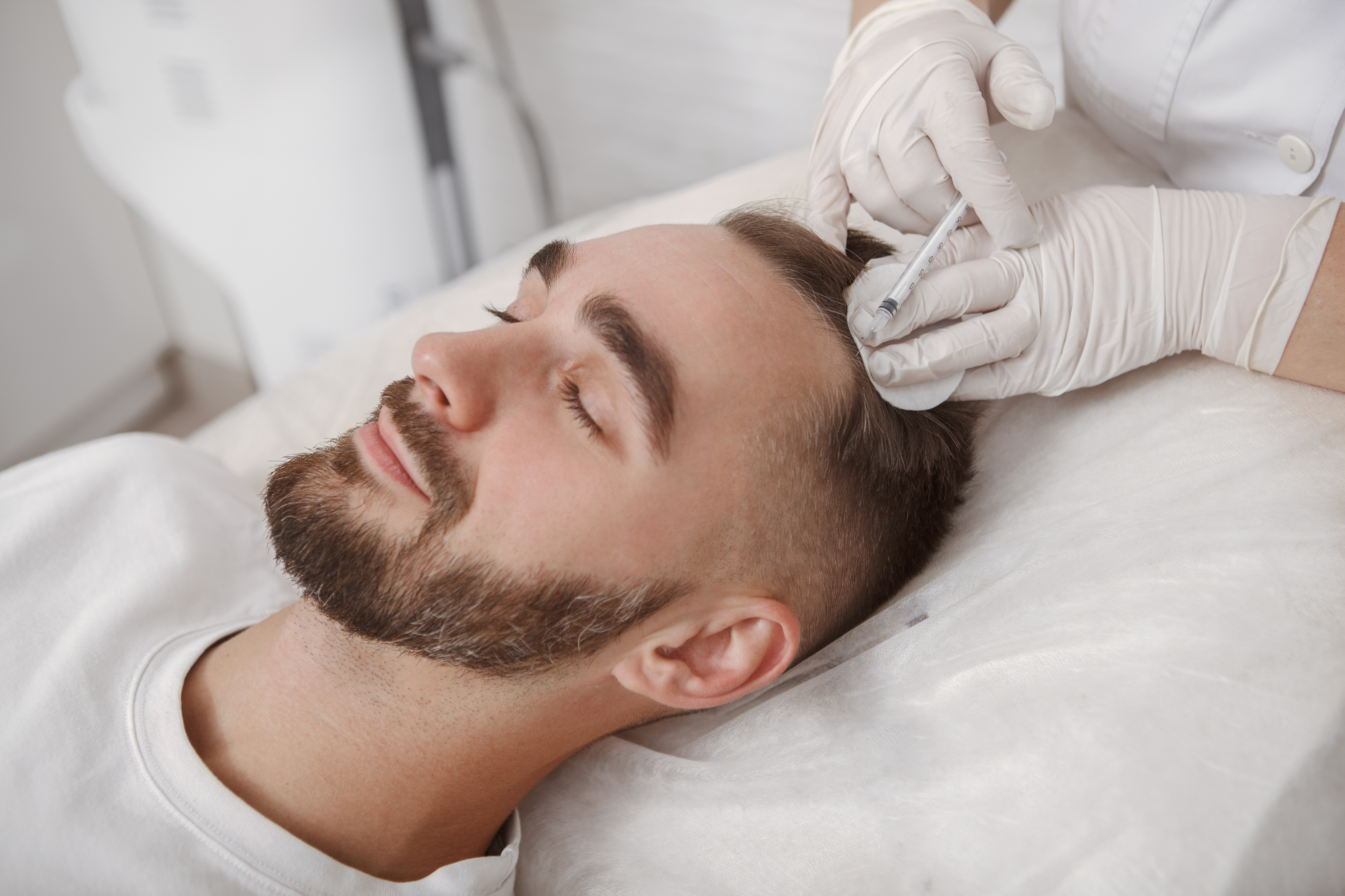 SMP Hairline Restoration