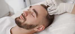 A man gets a PRP treatment for hair loss