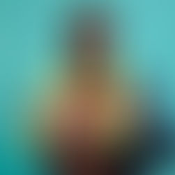 Why Injury Prevention is Essential for Young Athletes