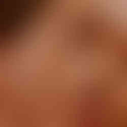 Primer plano de un rostro sano
