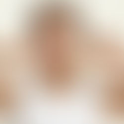 Nos conseils pour une belle peau sans boutons