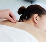 Treating with Acupuncture