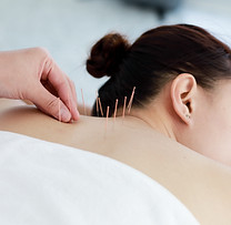 Treating with Acupuncture