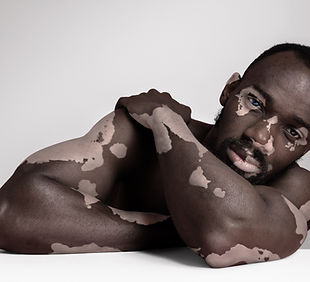 Beleza na pigmentação