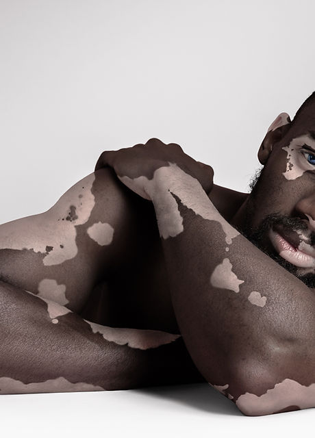 Beauty in Pigmentation