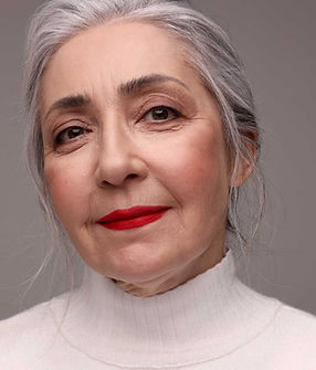 Dermal filler for cheeks and lips, from Fine Lines Aesthetics in Devon