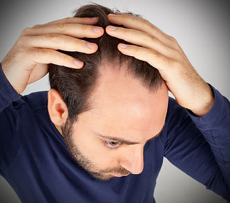 Caucasian young man controls hair loss