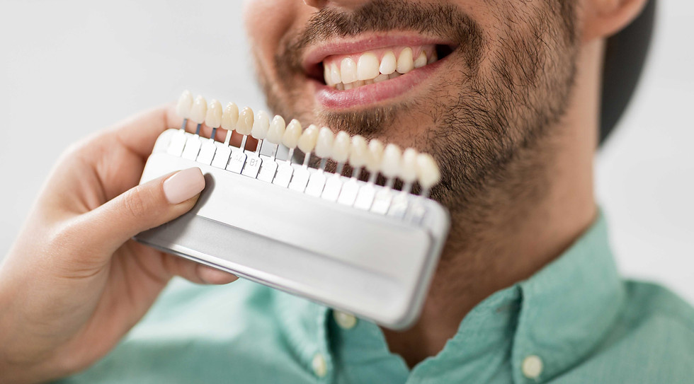 Dental Color Matching