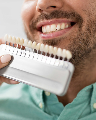 Dental Color Matching