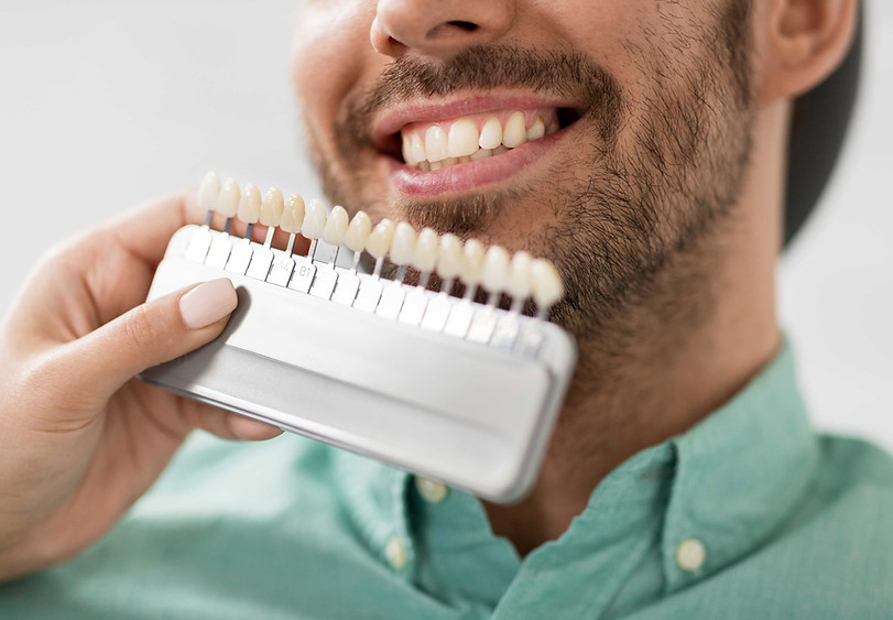 Dental Color Matching