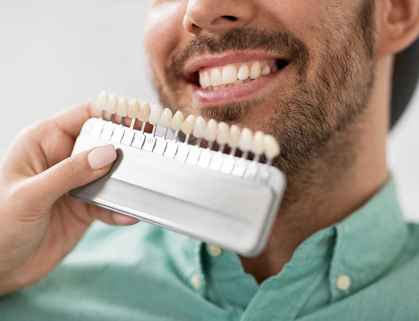 Dental Color Matching