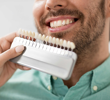 Combinação de tons de dentes