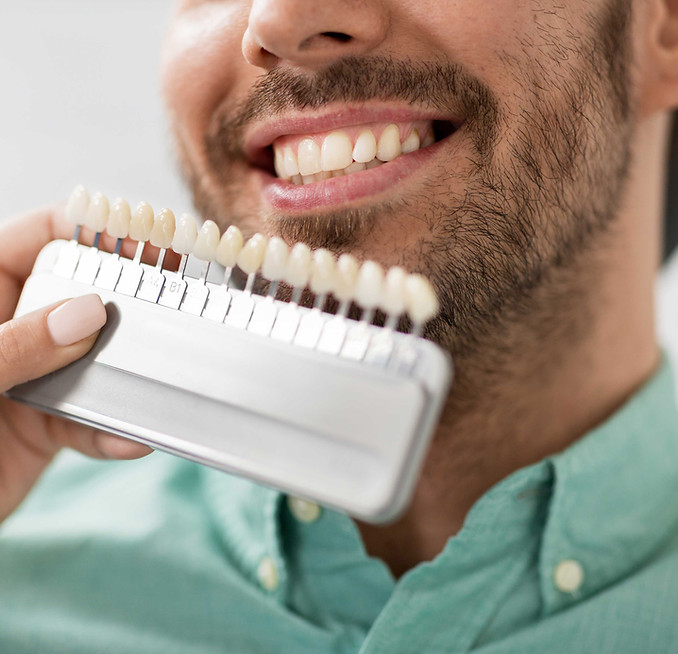 Dental Color Matching