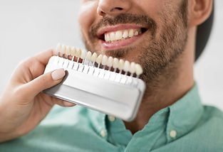 Tandheelkundige kleurmatching