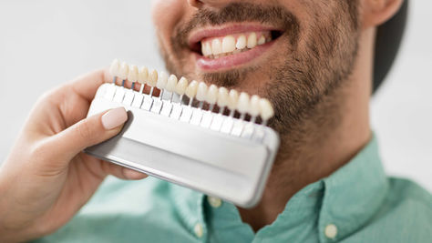 What is the Whitest Tooth Shade for Your Smile?