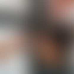 Finasteride for Hair Loss: How This Powerful DHT Blocker Works & Whether It’s Right for You