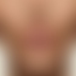 Mouth and lips 