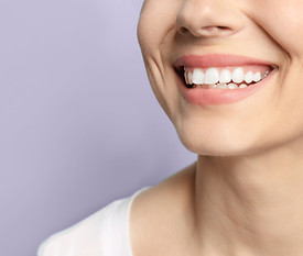 smile_facialimplant
