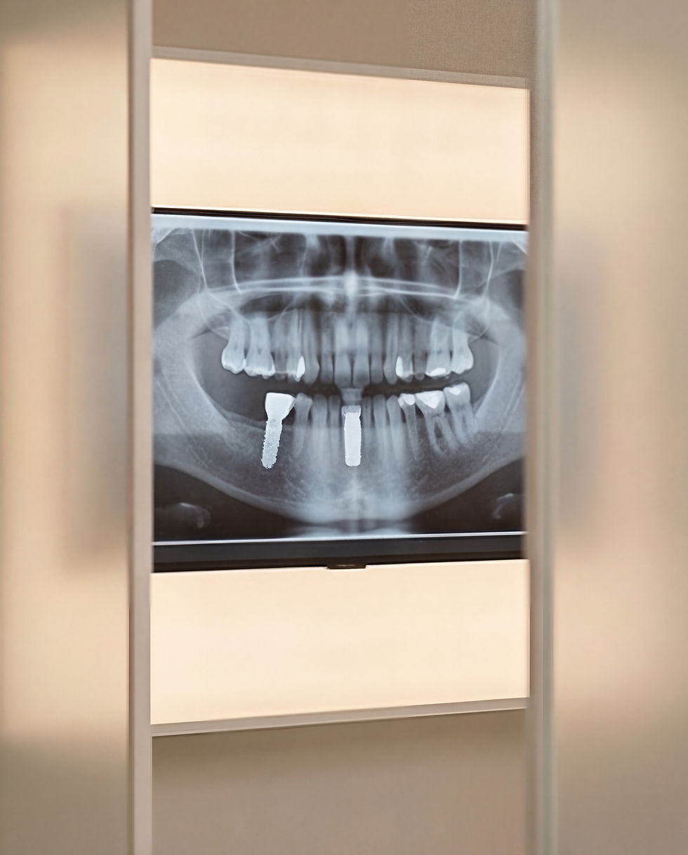 Dental X-Ray Image