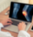 Joint Pain