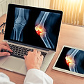 Joint Pain