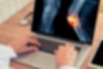 Joint Pain