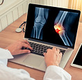 Joint Pain
