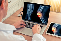 Joint Pain