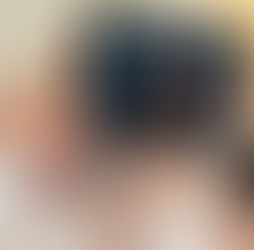 Cracking, Creaking Joints