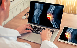 Knee X-Ray Diagnosis