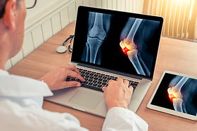 arthritis, physical therapy
