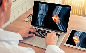 Joint Pain
