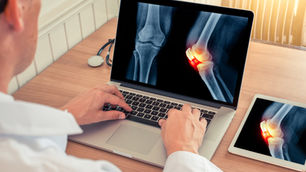 Verständnis von Arthritis: Ursachen, Symptome und Behandlungsmöglichkeiten