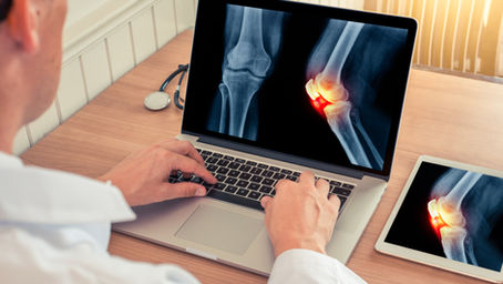 Kipuviestin kulku ja kivun säätely