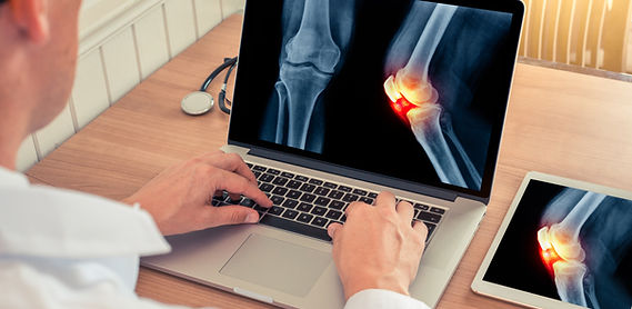 A doctor in a white coat is looking at a laptop. The laptop is displaying an x-ray image of a knee. There is also a tablet on the table with the same x-ray image of the knee.
