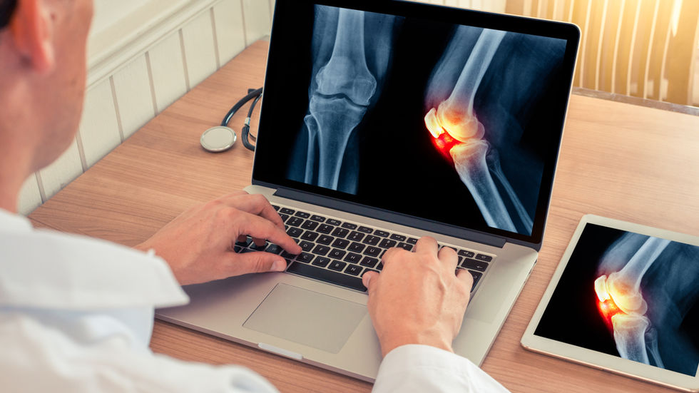 Bone-Strengthening Foods: What to Eat for Faster Healing and Stronger Bones