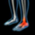 Human foot pain with the anatomy of a skeleton foot