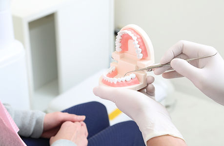 歯科治療イメージ