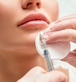 Injeção de Botox labial