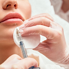 Lip Fillers in Austin