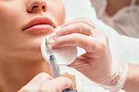 Injeção de Botox labial