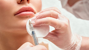 Descubre el Tratamiento Ideal para tus Labios con Ácido Hialurónico
