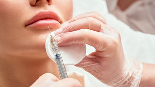 Mitos e verdades sobre preenchimento labial: o que você precisa saber