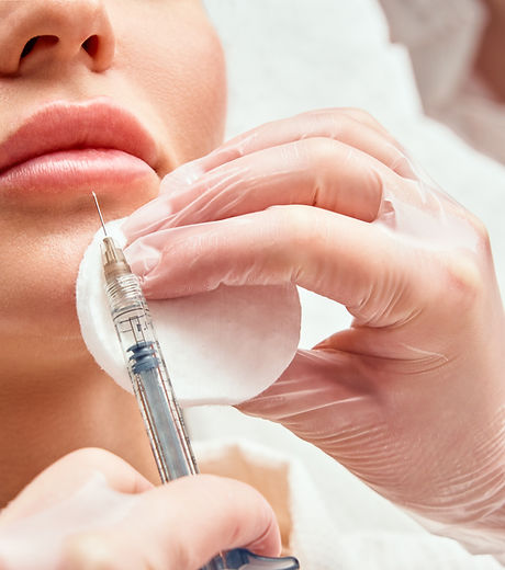 Lip Botox Injection