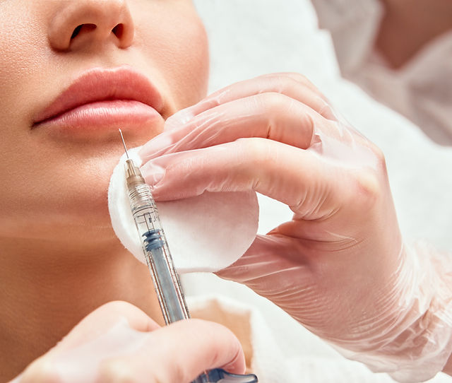 DERMAL FILLER | Nurse Michaela