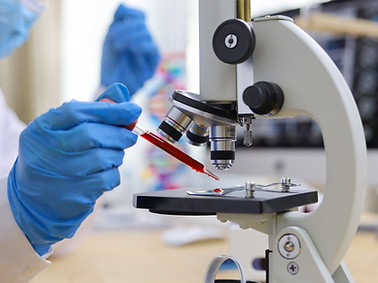 Examining Blood Sample