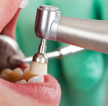 Dental Cleaning