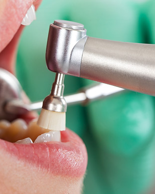Dental Cleaning
