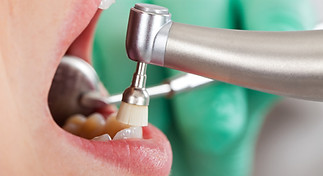 Dental Cleaning Procedure